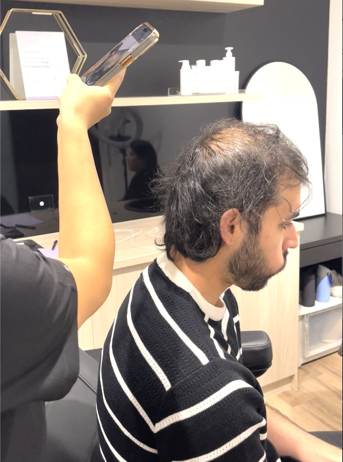Holistic hair loss approach at Yuna Skin Clinic Melbourne